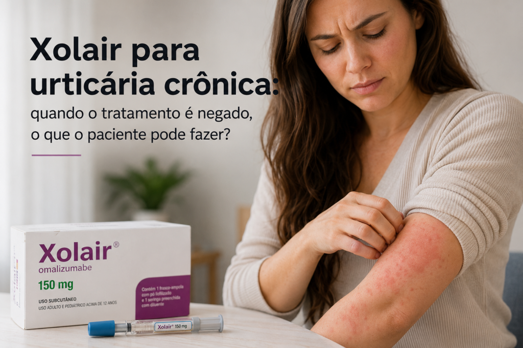 Xolair para urticária crônica: quando o tratamento é negado, o que o paciente pode fazer? Xolair para urticária crônica: quando o tratamento é negado, o que o paciente pode fazer?