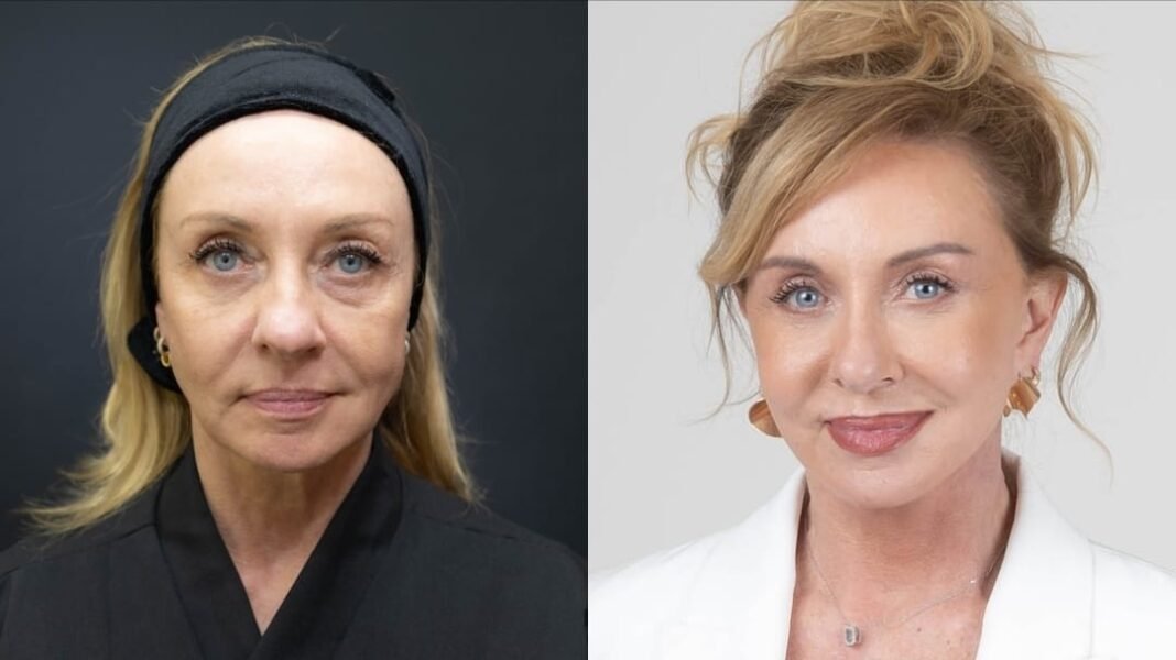 “Bem-vindos ao luxo”: facelift reforça imagem de corretora de alto padrão Mônica Poplawski, corretora especializada no mercado imobiliário de luxo em Alphaville, São Paulo, utiliza a própria imagem como uma das ferramentas de seu trabalho.